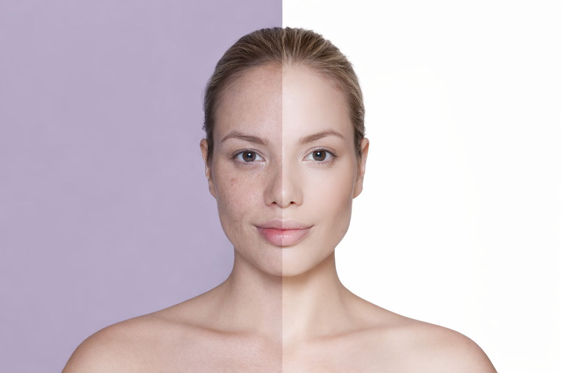 Peau terne : quelles solutions naturelles efficaces ?