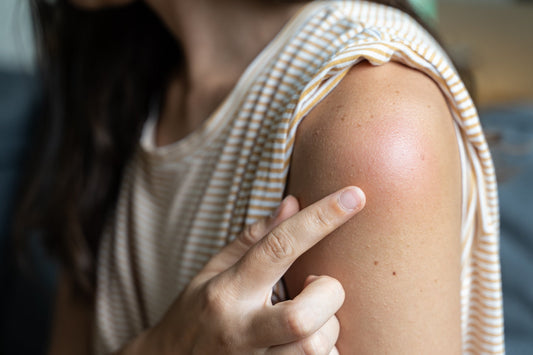 peau qui gratte sans raison démangeaisons causes et solution naturelle peau irritée